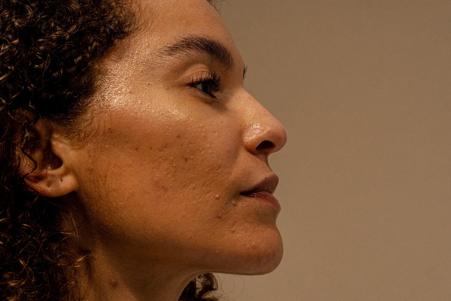 Is Acne Medication Healing Your Skin – Or Hiding the Root Cause?