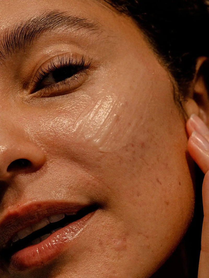 Adult Acne Bundle Bundle Primally Pure